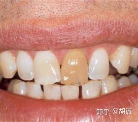 医生是不是有一些“黑话”？-1.jpg