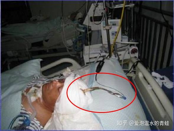 医生是不是有一些“黑话”？-2.jpg
