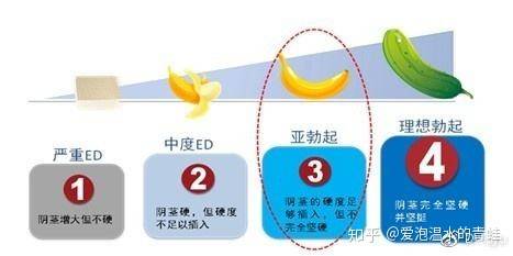 医生是不是有一些“黑话”？-7.jpg