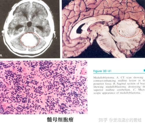 医生是不是有一些“黑话”？-5.jpg