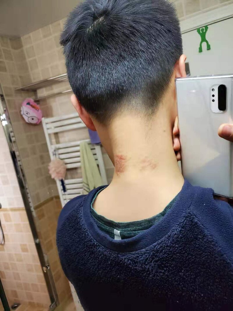 李佳琦推荐的SKG颈椎仪真的好用吗？-1.jpg