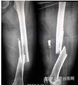 你们都有哪些被骗过的经历？-4.jpg