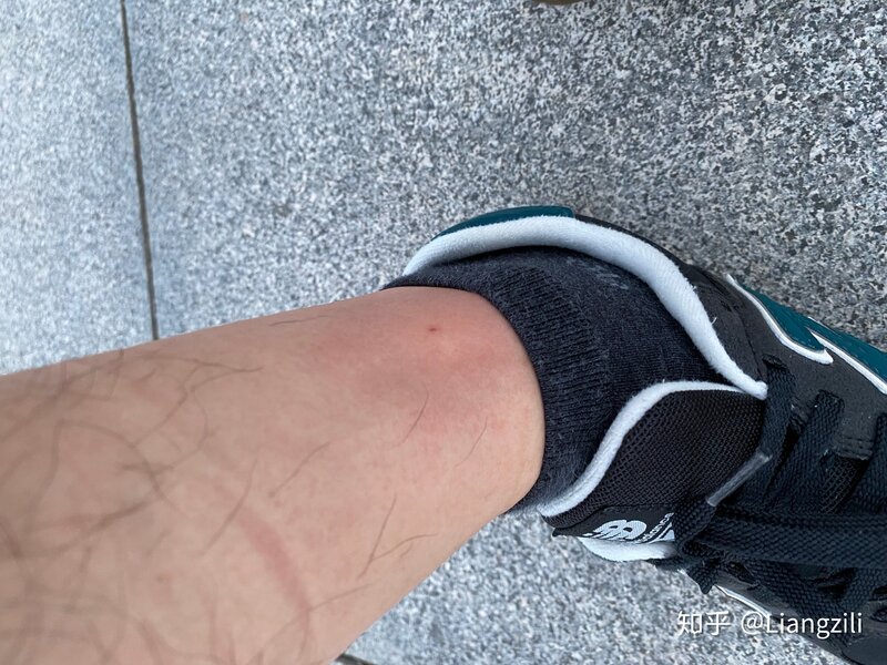 被马蜂蛰了是种什么体验-1.jpg