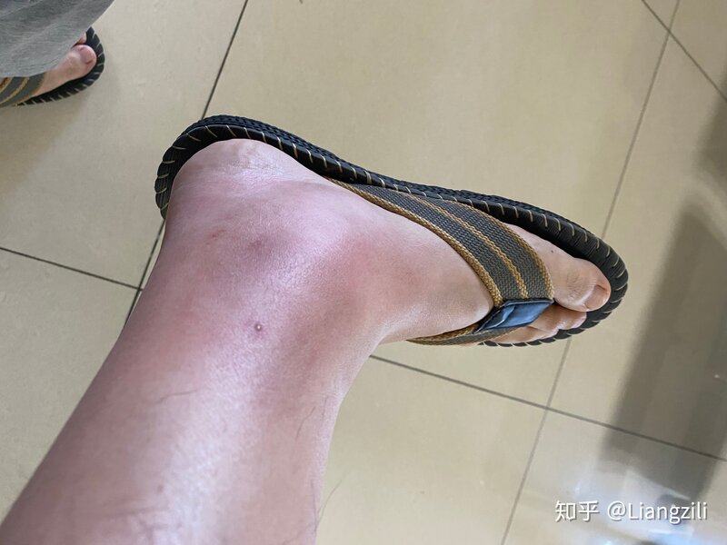 被马蜂蛰了是种什么体验-4.jpg