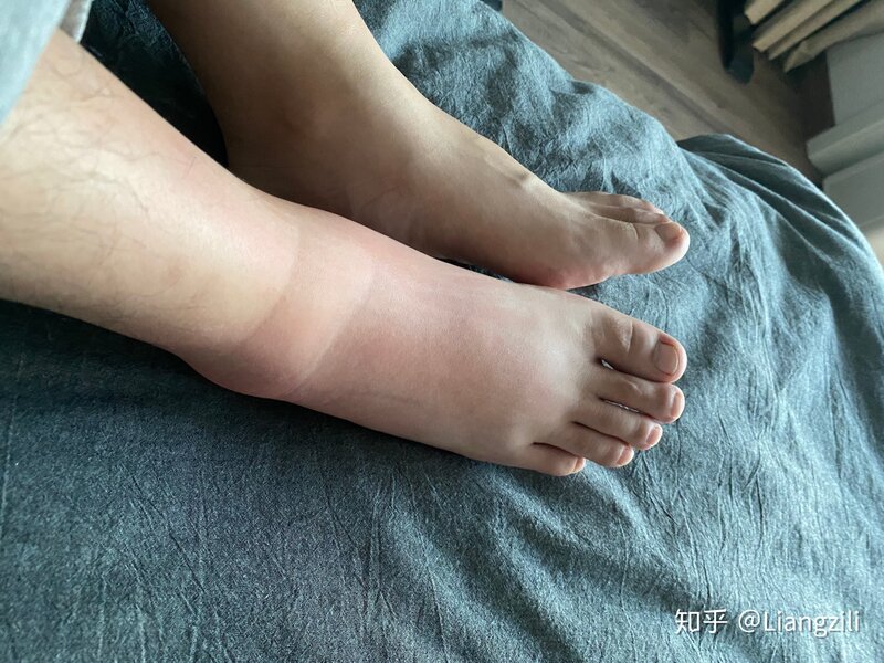 被马蜂蛰了是种什么体验-6.jpg
