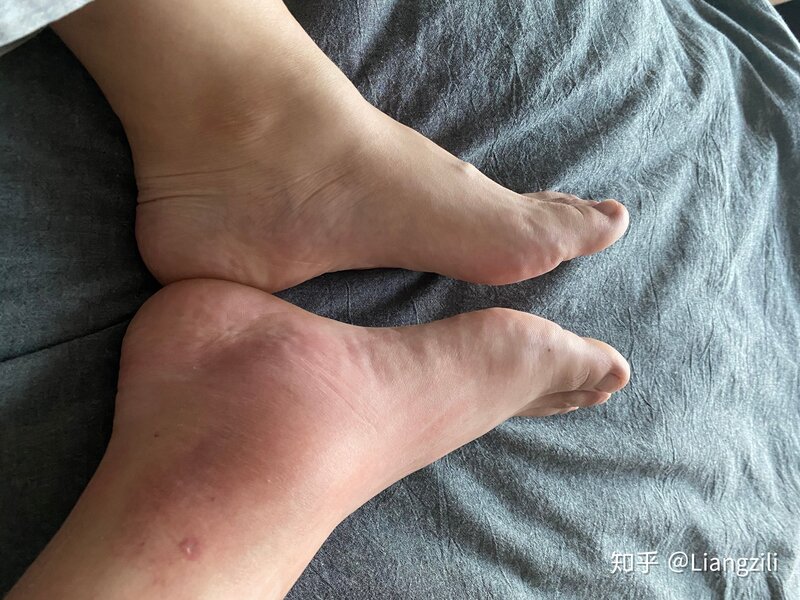 被马蜂蛰了是种什么体验-7.jpg