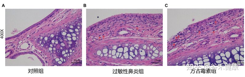 肠道微生物群在过敏性鼻炎中的作用-4.jpg