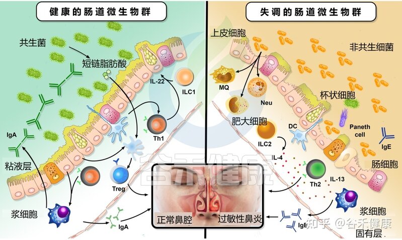 肠道微生物群在过敏性鼻炎中的作用-12.jpg