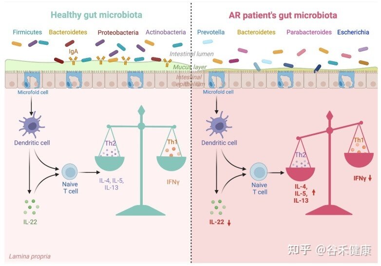 肠道微生物群在过敏性鼻炎中的作用-11.jpg