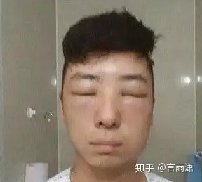 眼霜能去掉熊猫的黑眼圈吗？为什么？-3.jpg